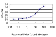 Monoclonal Mouse anti-Human GP1BA / CD42b Antibody (clone 1C6, WB)
