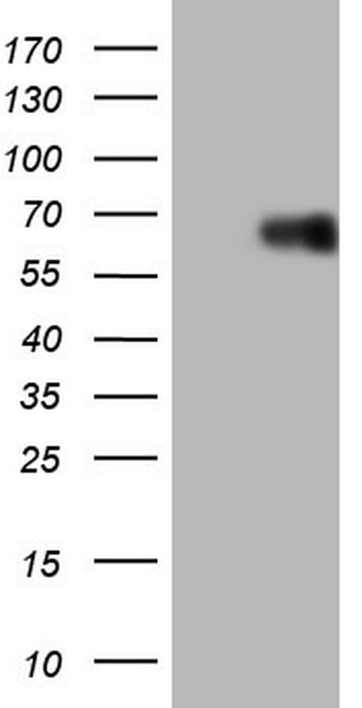 LRRTM1 Antibody (aa182-422, clone OTI2C6)