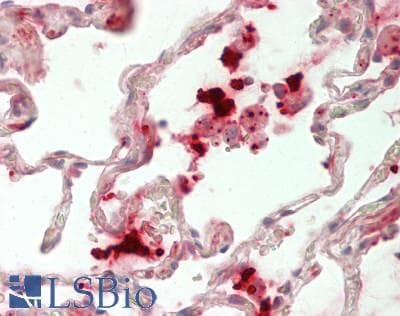 SIPR2 / S1P2 / EDG5 Antibody