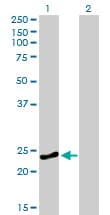 RAB4A / RAB4 Antibody (clone 1C10)