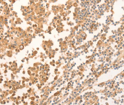 Polyclonal Rabbit anti-Human NAP1L1 Antibody (IHC, WB)