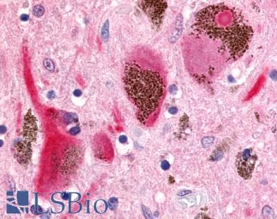 PathPlus™ PACE4 / PCSK6 Antibody (Cytoplasmic Domain)