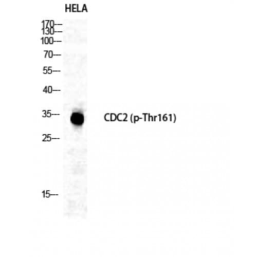 Polyclonal Rabbit anti-Human CDK1 / CDC2 Antibody (100-180 aa, IHC, WB)