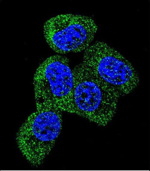 Polyclonal Rabbit anti-Human MAPT / Tau Antibody (aa677-707, IHC, IF, WB)