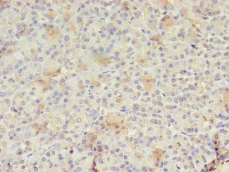 Polyclonal Rabbit anti-Human RAB30 Antibody (IHC, WB)