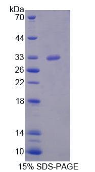 Human MED6 Protein (Recombinant His, N-Terminal)