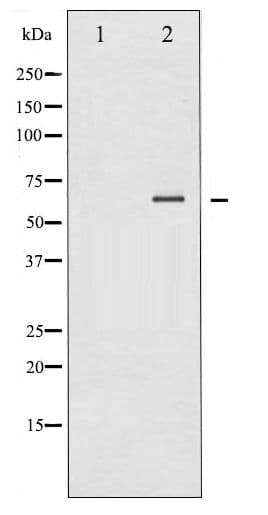 Polyclonal Rabbit anti-Human SYK Antibody (phospho-Tyr348, IHC, WB)
