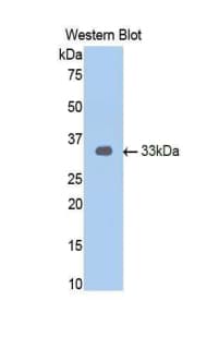 AR / Androgen Receptor Antibody (aa15-246, Biotin)