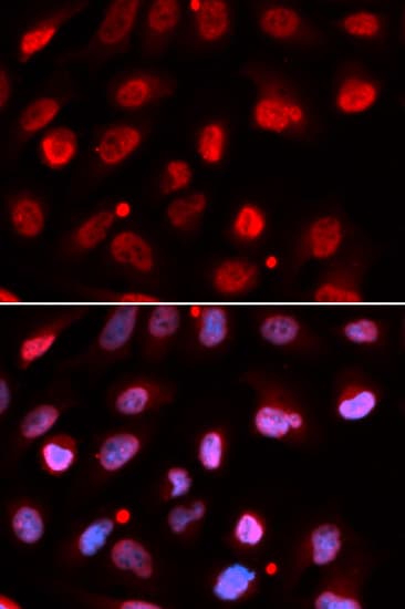 RNF2 / RING2 / RING1B Antibody