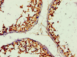 IHC-plus™ ALDH1B1 Antibody (aa278-517)