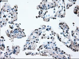 BRAF / B-Raf Antibody (clone OTI4C11)