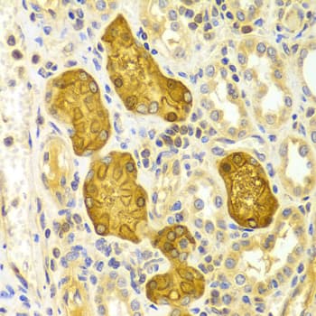 PRKCE / PKC-Epsilon Antibody