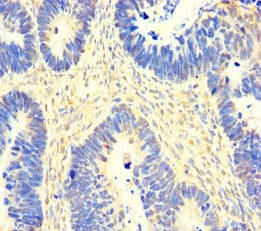SACM1L / SAC1 Antibody