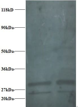 RPS9 / Ribosomal Protein S9 Antibody