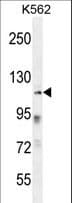 Polyclonal Rabbit anti-Human ZNF99 Antibody (aa124-153, WB)
