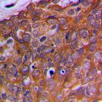 Polyclonal Rabbit anti-Human OAZ1 / OAZ Antibody (N-Terminus, IHC, WB)