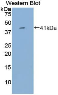 IL1R1 Antibody (aa20-338)