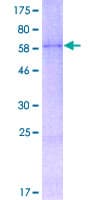 Human WNT2 / IRP Protein (Recombinant GST)
