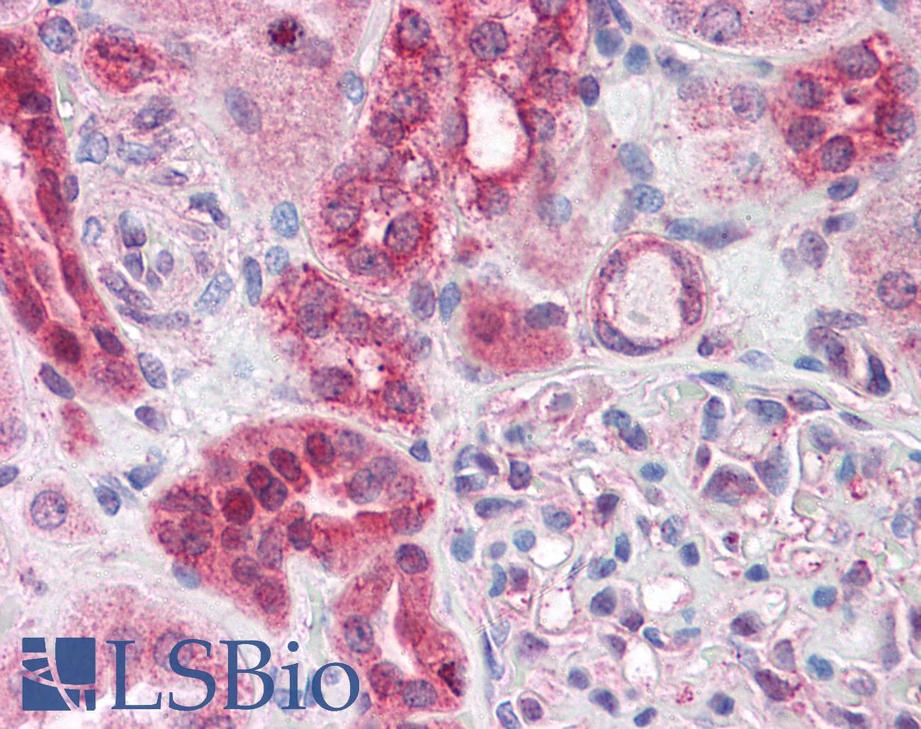 IHC-plus™ ABCD4 Antibody (aa136-149)
