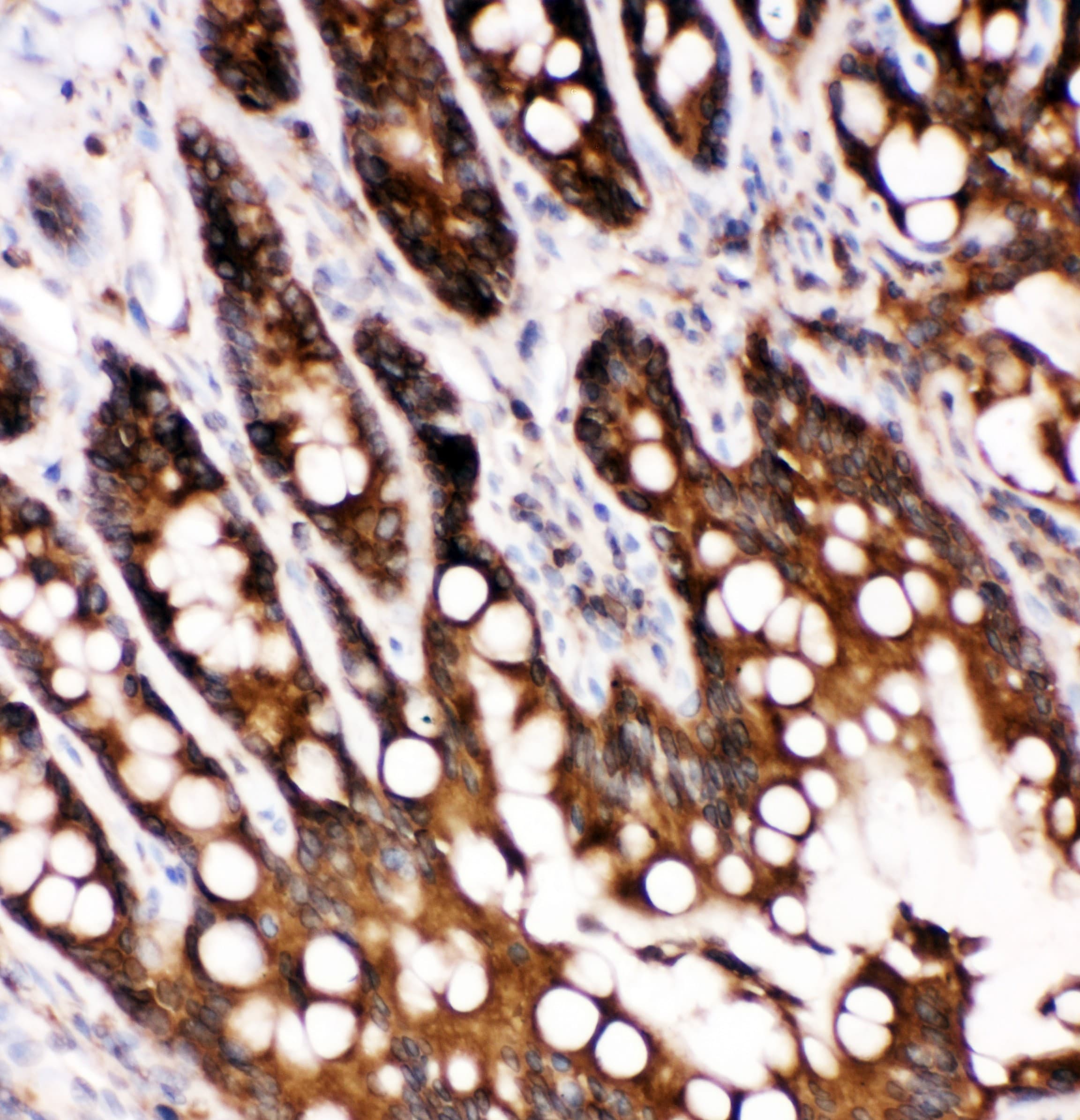 CASP6 / Caspase 6 Antibody (aa7-27)
