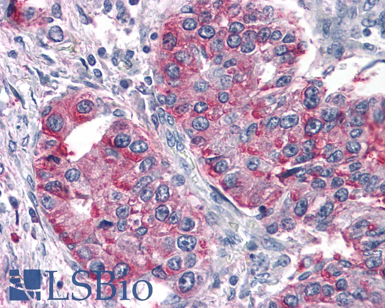 PathPlus™ Polyclonal Rabbit anti-Human T1R3 / TAS1R3 Antibody (N-Terminus, IHC)