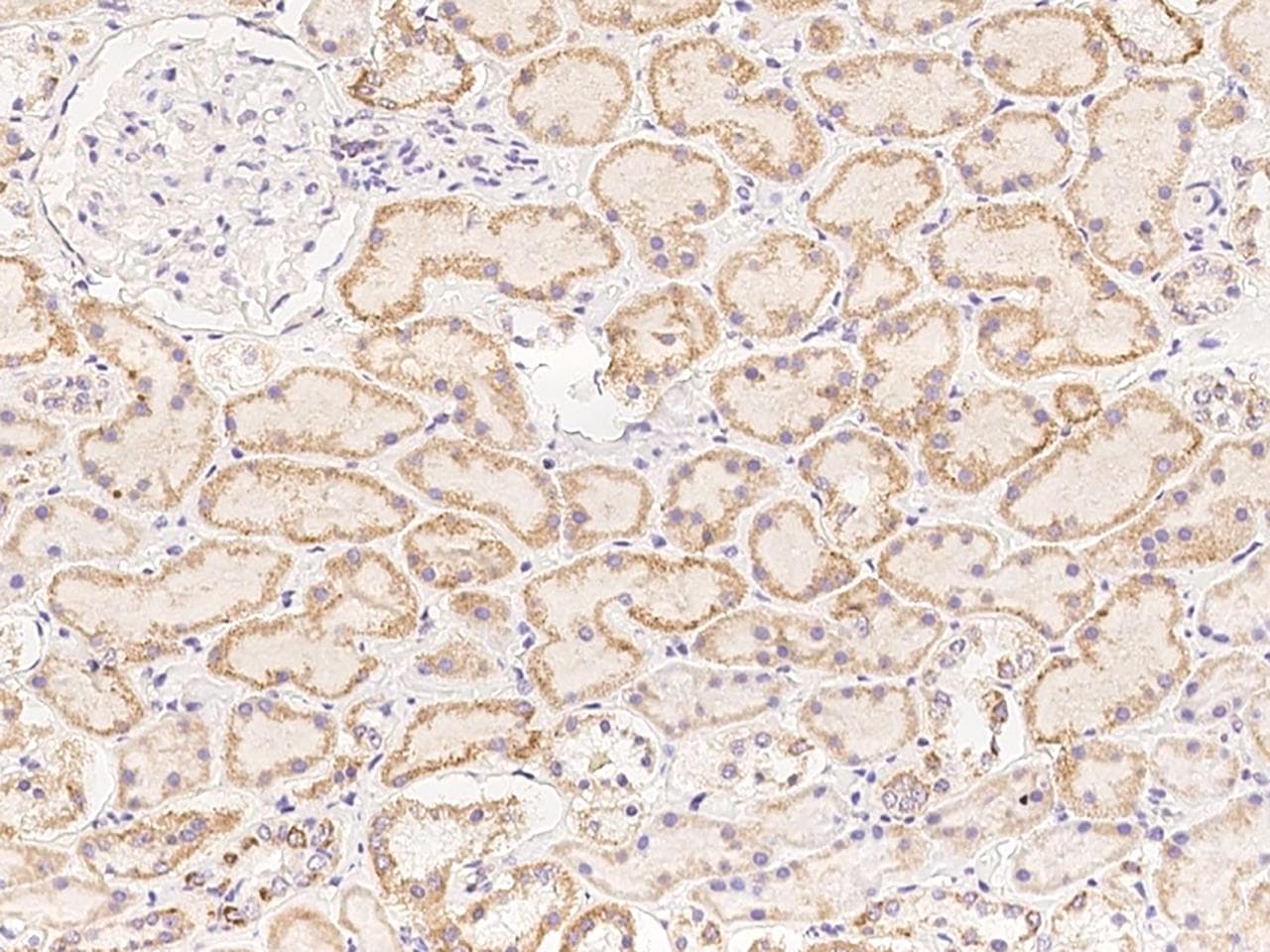 STKLD1 / SgK071 Antibody