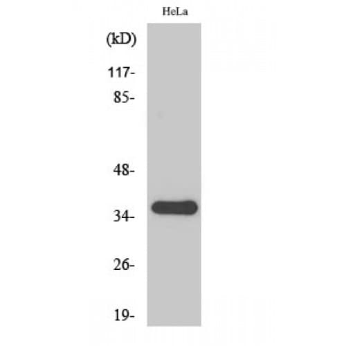 SFRP2 Antibody (90-170 aa, Internal)