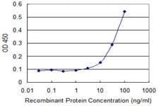 ARHGDIB / D4 GDI Antibody (clone 2C12-B6)