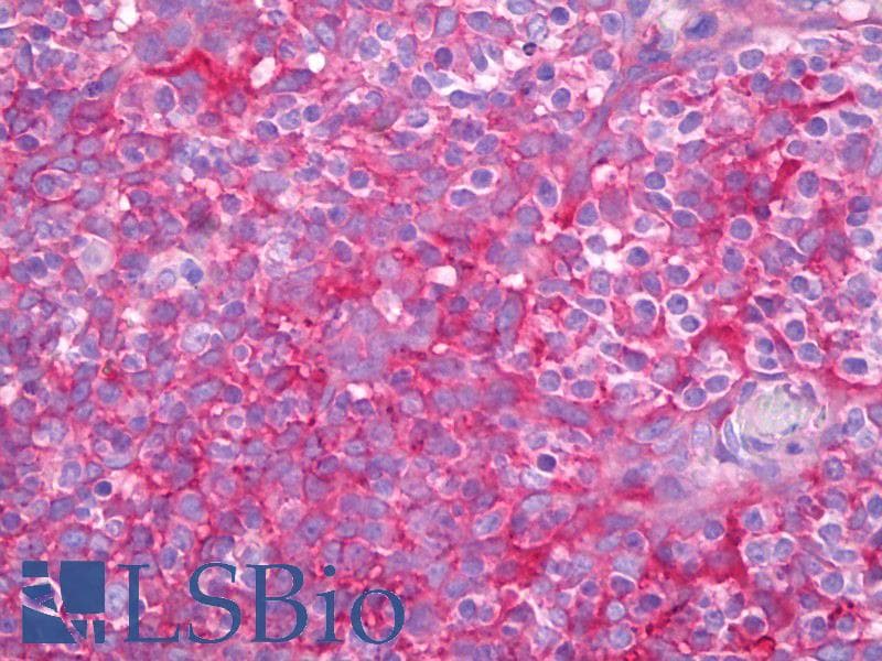 IHC-plus™ B2M / Beta 2 Microglobulin Antibody