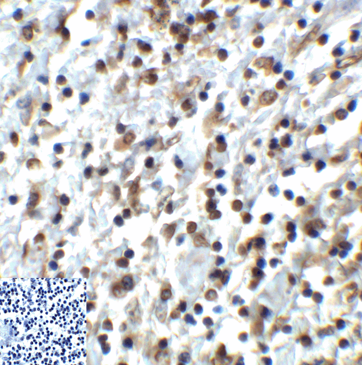 Monoclonal Mouse anti-Human TIGIT Antibody (clone 4A12, IHC, IF, WB)