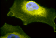 SOD1 / Cu-Zn SOD Antibody