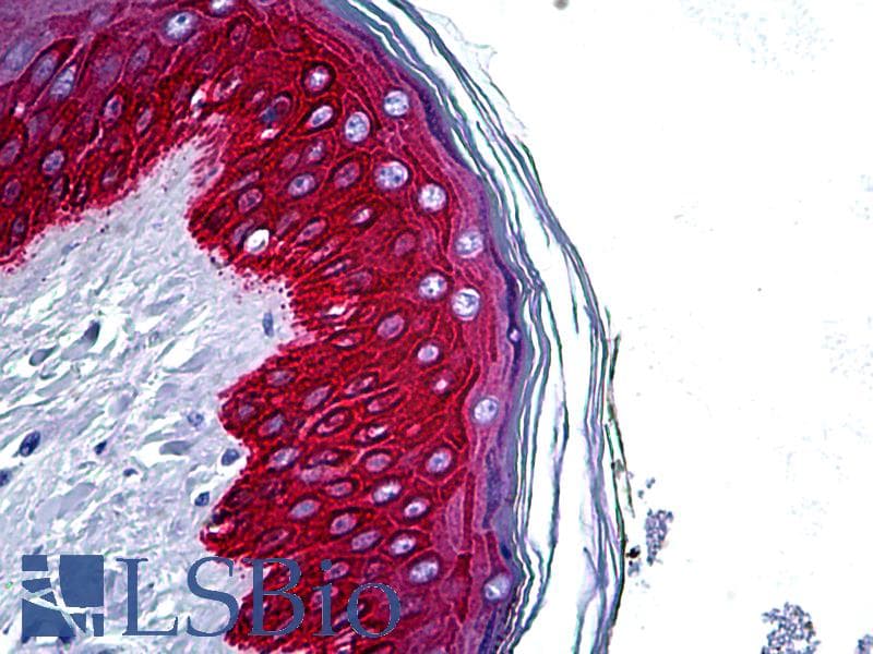 IHC-plus™ KRT14 / CK14 / Cytokeratin 14 Antibody (C-Terminus)
