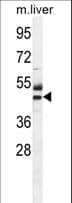 Polyclonal Rabbit anti-Human CTU1 Antibody (aa208-236, IHC, WB)