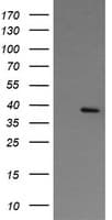 Monoclonal Mouse anti-Human NUDT9 Antibody (clone OTI 7F12, WB)