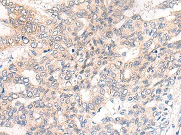 Chordin Antibody