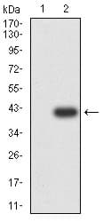 CCR7 Antibody (clone 7A5A9)