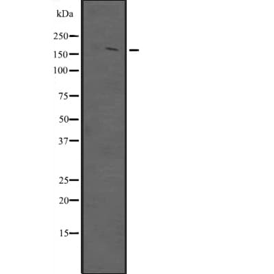 POGZ Antibody