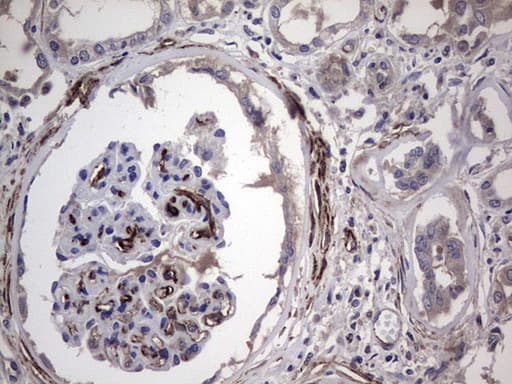 IHC-plus™ CDH4 / R Cadherin Antibody (aa170-428, clone 6H5)