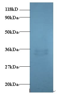PMP2 / FABP8 Antibody