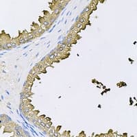 PPIC / Cyclophilin C Antibody