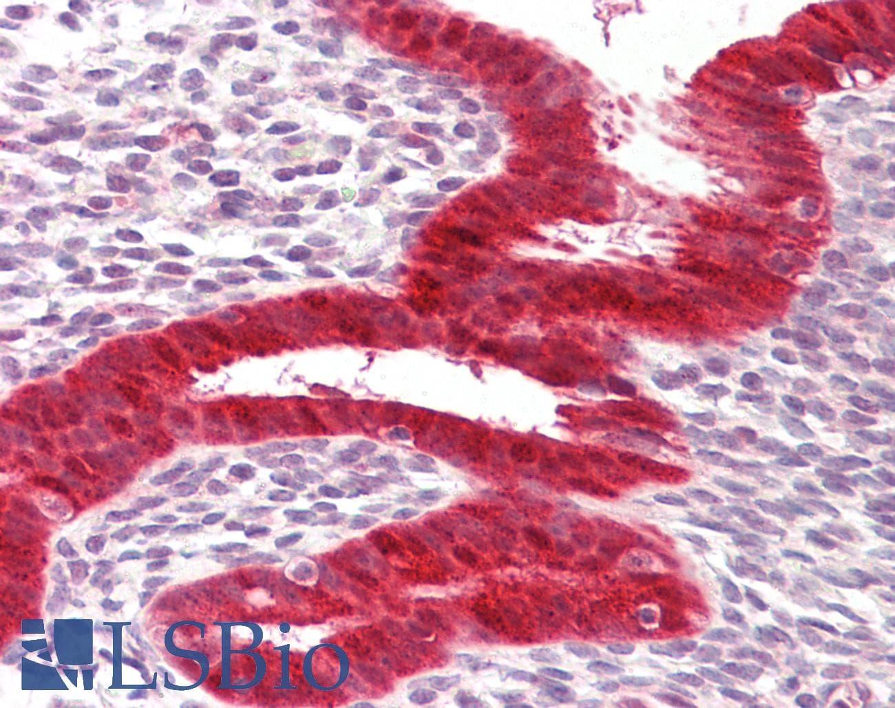 IHC-plus™ DDX58 / RIG-1 / RIG-I Antibody (aa200-250)