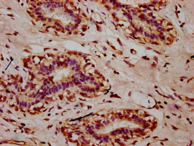 Polyclonal Rabbit anti-Human HIST1H2AI Antibody (IHC)