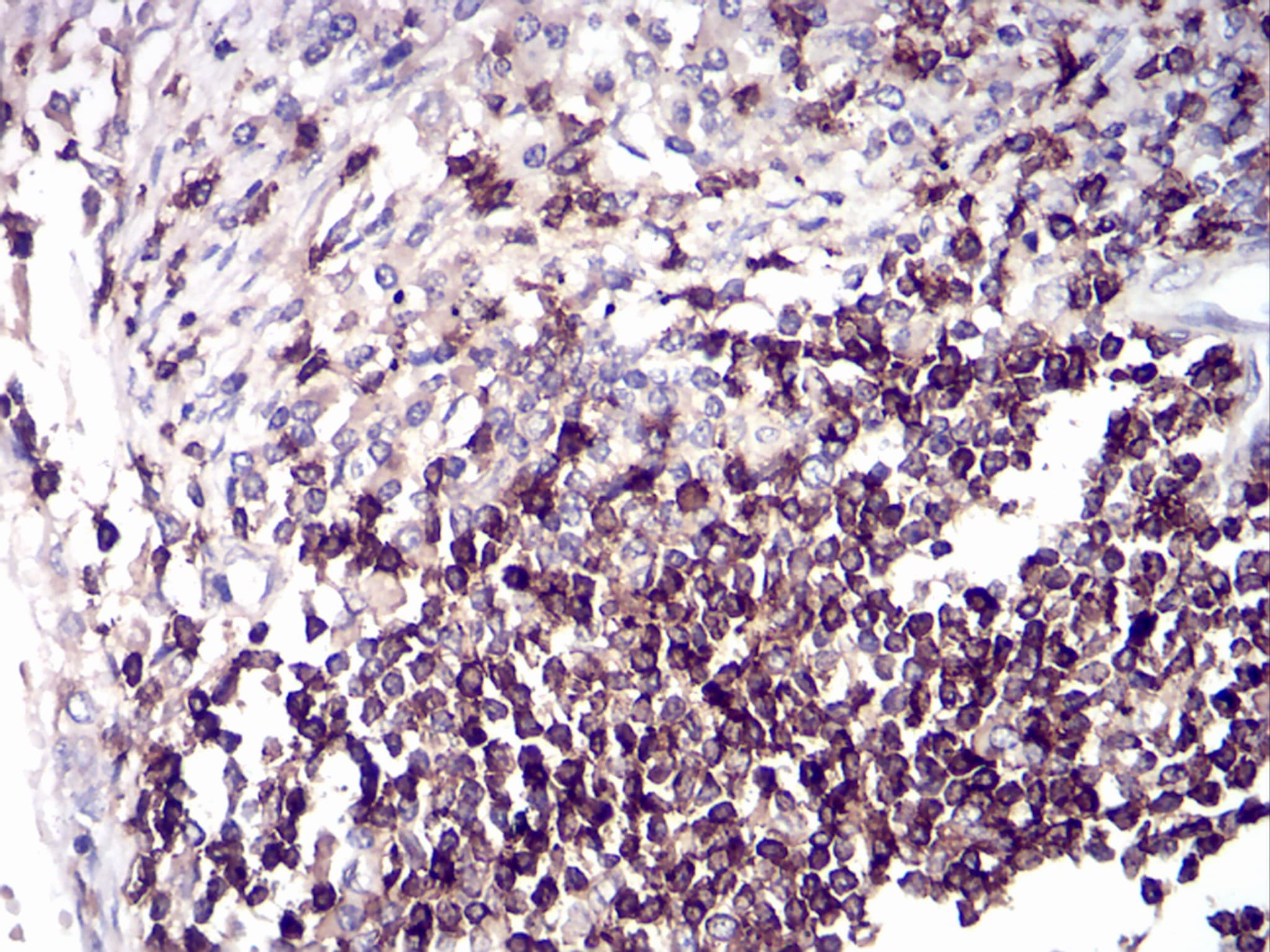 Monoclonal Mouse anti-Human CD6 Antibody (clone 5A10A2, IHC, WB)
