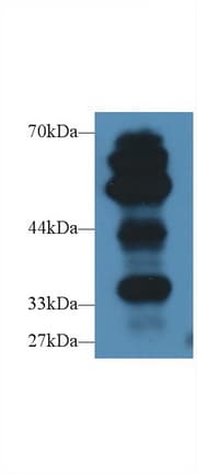 AGER / RAGE Antibody (aa10-188)