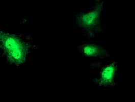 FGF21 Antibody (clone OTI1H4)