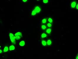 SSB / La Antibody (clone OTI3H9)