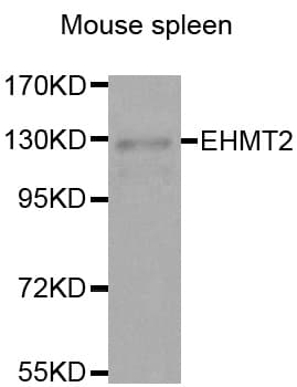 Polyclonal Rabbit anti-Human EHMT2 / G9A Antibody (IHC, WB)