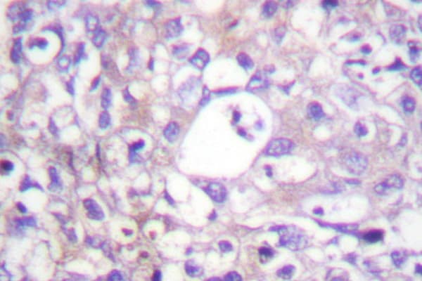 PTPN11 / SHP-2 / NS1 Antibody (Glu574)