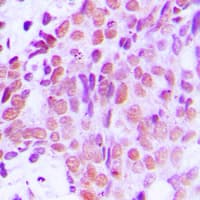XRCC1 Antibody (C-Terminus)
