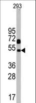 Polyclonal Rabbit anti-Human NPTX1 Antibody (aa364-393, IHC, WB)